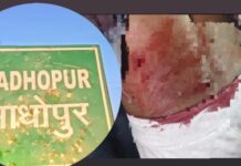 बारात में गाना बजाने को लेकर चाकूबाजी, युवक गंभीर रूप से घायल।