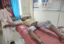 सिलेंडर लीक होने के कारण चौकीदार के पुत्र के द्वारा लाइटर जलाते ही बदन में आग पकड़ा।